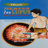 Image of Obati Herpes dan Lupus dengan Tepat